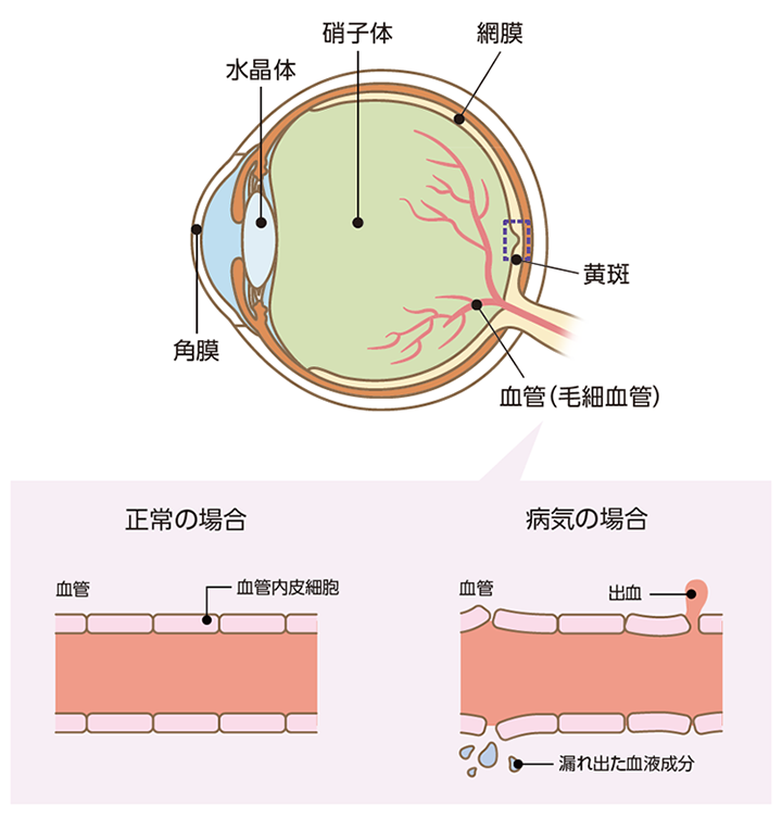 網膜の血管と眼の健康のイメージ