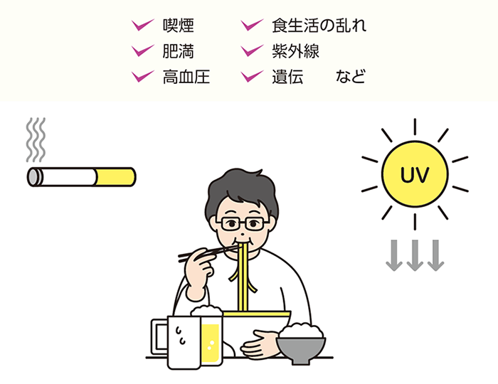 喫煙・食生活の乱れ・紫外線のイラスト